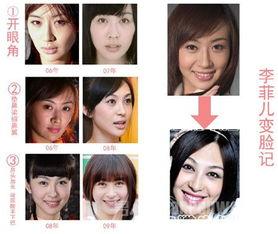 西安整容爆料事件视频最新,揭秘行业乱象，患者权益引关注  第1张